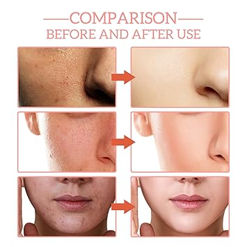 Anti-wrinkle Facial Serum